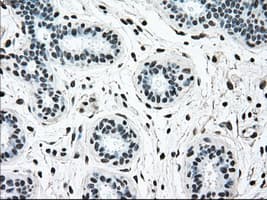 Monoclonal Mouse anti-Human BRAF / B-Raf Antibody (clone OTI4G6, IHC, WB)