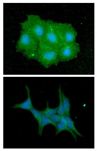 IMPA1 / IMP Antibody (clone AT2G5)