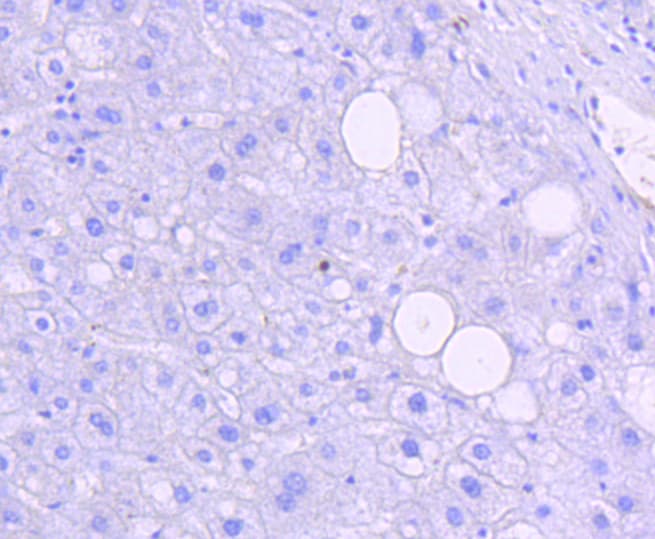JNK1+2+3 Antibody (JNK1 phospho-Thr183 and JNK2 pThr183 and JNK3 pThr221)