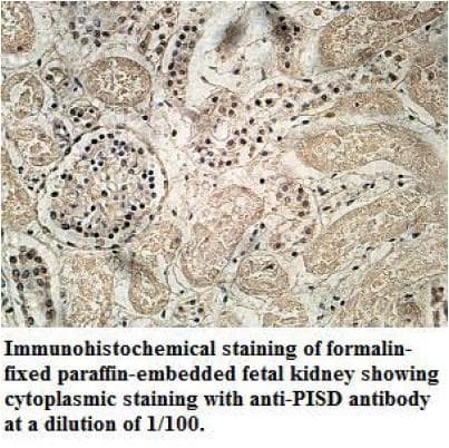 Polyclonal Rabbit anti-Human DJ858B16.2 / PISD Antibody (aa71-310, IHC, WB)