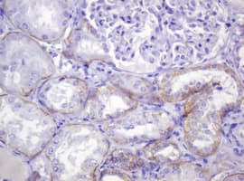 CTNND1 / p120 Catenin Antibody (clone OTI2E8)