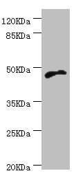 Polyclonal Rabbit anti-Human CYTH2 / Cytohesin 2 Antibody (IHC, WB)