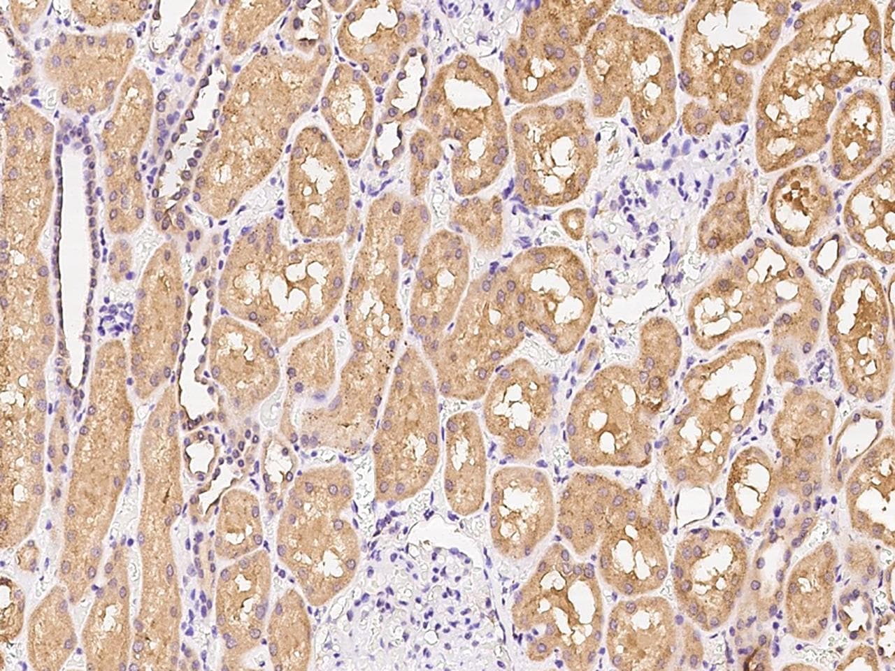AKR1C4 / Chlordecone Reductase Antibody