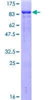 Human CHEK2 / CHK2 Protein (Recombinant GST)