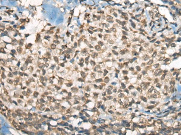 PIAS3 Antibody