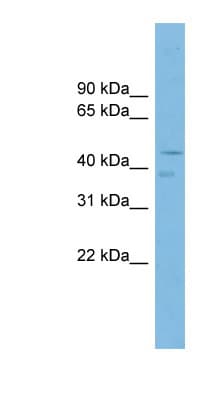 P2RX6 / P2X6 Antibody (aa35-84)