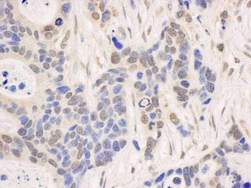 NCBP1 / CBP80 Antibody (aa482-532)