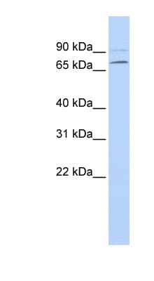 YTHDF3 Antibody (aa72-121)