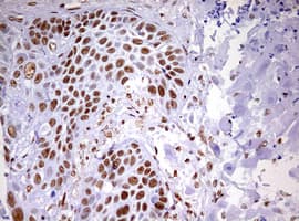 DDX56 Antibody (aa323-547, clone OTI2E5)