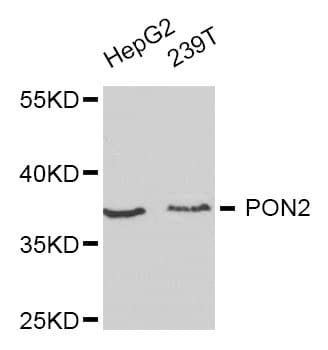 Polyclonal Rabbit anti-Human PON2 Antibody (IHC, WB)