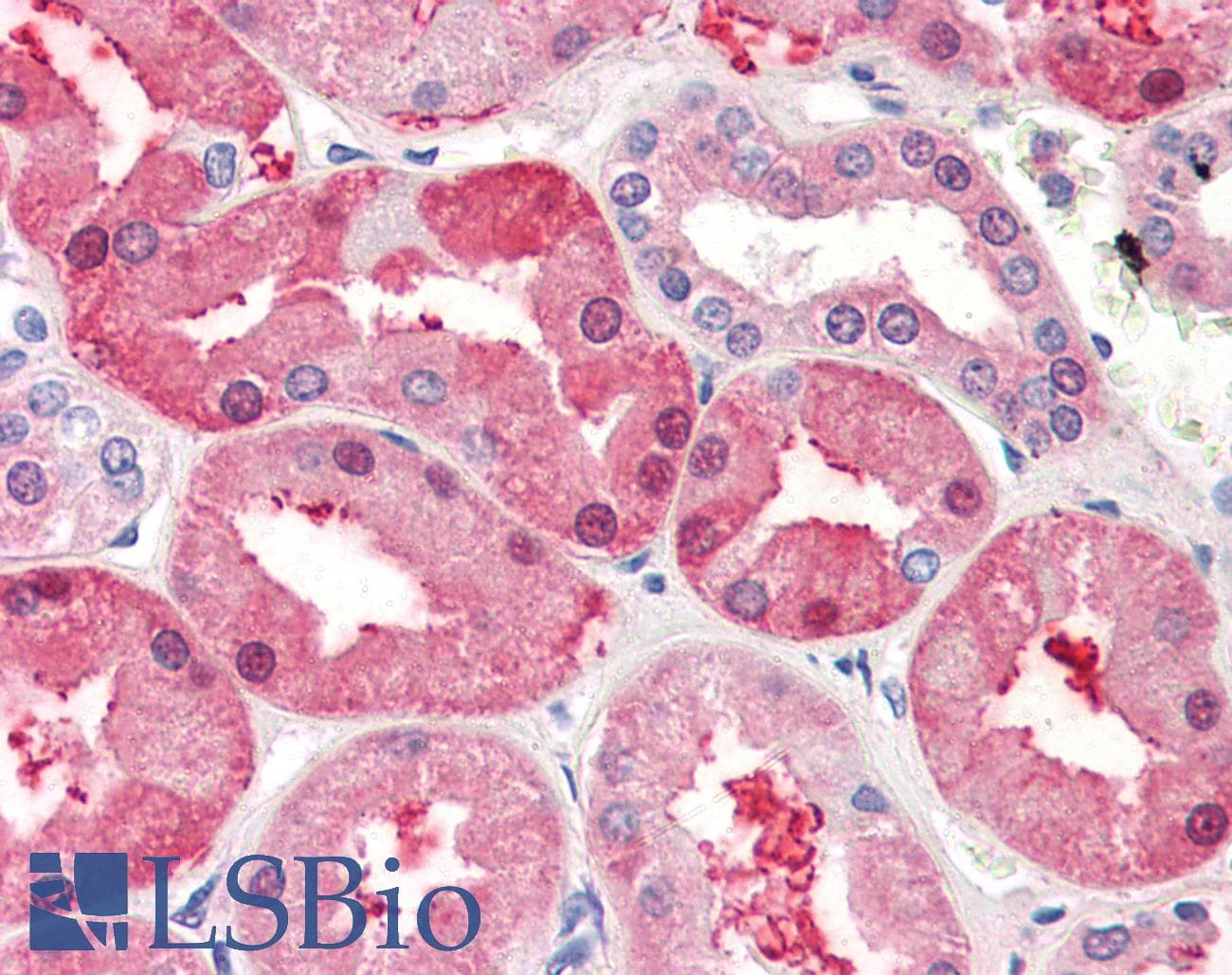 IHC-plus™ FABP1 / L-FABP Antibody (aa1-127, clone 2G4)