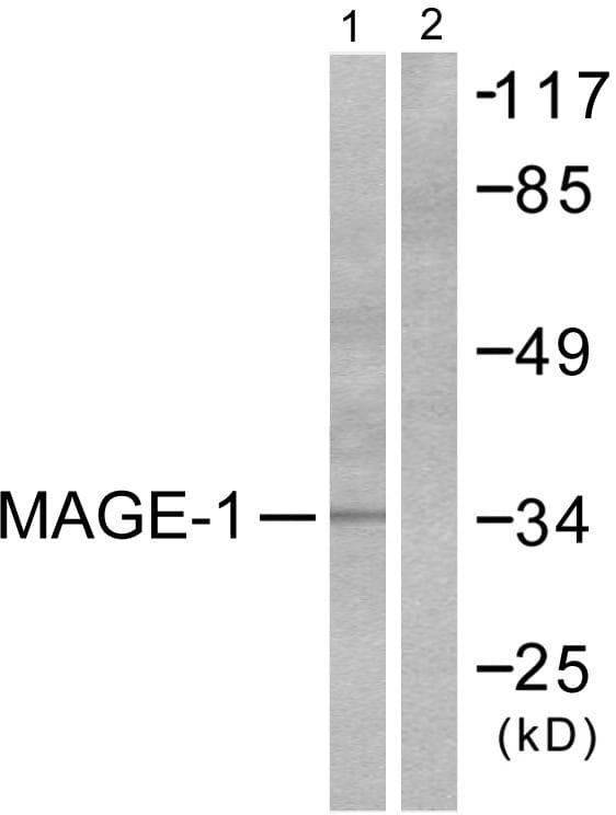 Polyclonal Rabbit anti-Human MAGEA1 / MAGE 1 Antibody (IHC, WB)