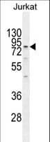 ELMO2 Antibody (aa323-350)