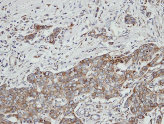 Polyclonal Rabbit anti-Human PON2 Antibody (aa1-295, IHC, WB)
