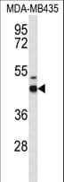 GABRD Antibody (aa331-358)
