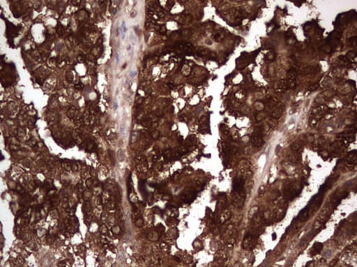 LGALS3 / Galectin 3 Antibody (clone OTI6E1)