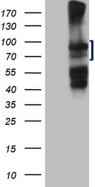Monoclonal Mouse anti-Human HGF / Hepatocyte Growth Factor Antibody (clone OTI1C6, aa200-494, WB)