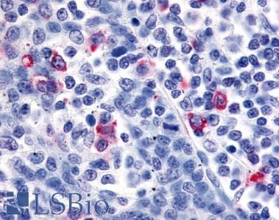 IHC-plus™ Polyclonal Rabbit anti-Human CXCR6 Antibody (Cytoplasmic Domain, IHC)