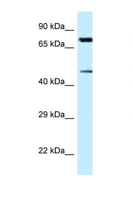 CDH22 / Cadherin 22 Antibody (aa111-160)