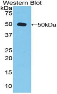 DVL3 / Dishevelled 3 Antibody (aa545-716)