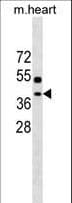 EMC2 / TTC35 Antibody (aa65-91)