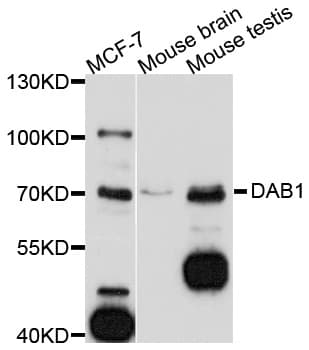 Polyclonal Rabbit anti-Human DAB1 Antibody (WB)
