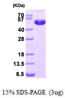 Human MAT / MAT1A Protein (Recombinant His)