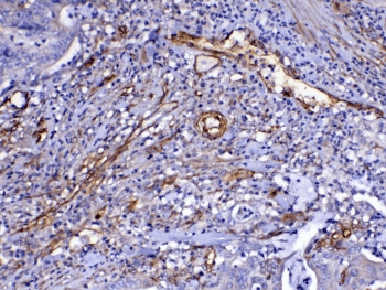 FLT4 / VEGFR3 Antibody