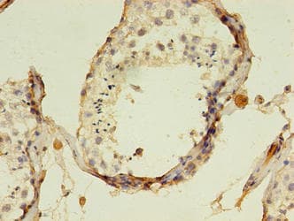 KATII / AADAT Antibody