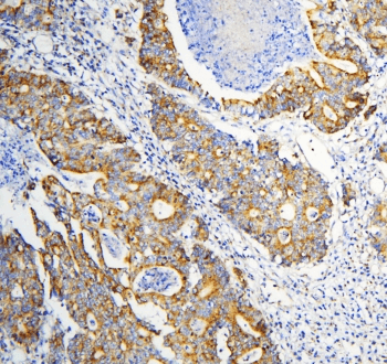 Polyclonal Rabbit anti-Human DARS2 Antibody (IHC, WB)