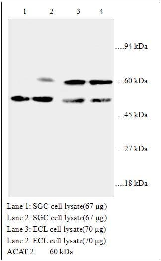 Polyclonal Rabbit anti-Human ACAT2 Antibody (WB)