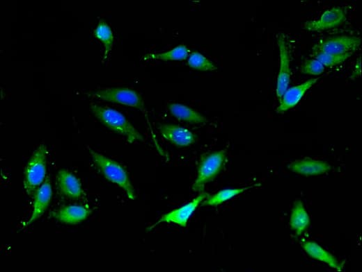 NCF1 / p47phox / p47 phox Antibody