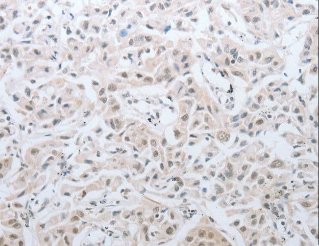 DNAJC7 Antibody