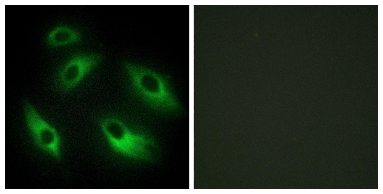 EPHB6 / EPH Receptor B6 Antibody