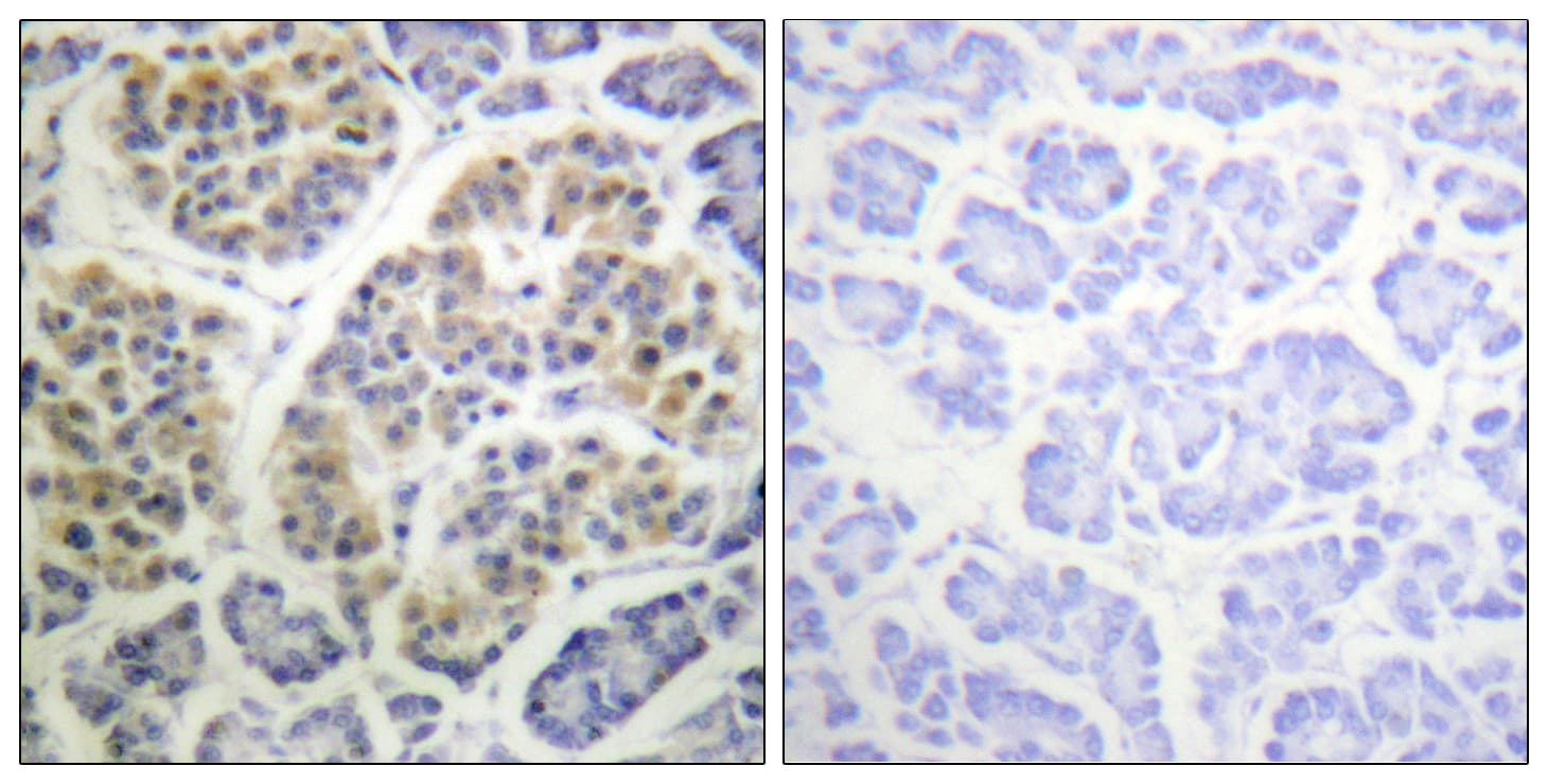 Polyclonal Rabbit anti-Human YWHAQ / 14-3-3 Theta Antibody (phospho-Ser232, IHC, IF, WB)