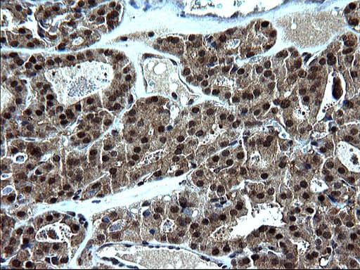 ZFAND3 / TEX27 Antibody (clone OTI1C5)