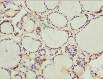 WDR47 Antibody