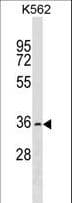 OR2AG2 / OR2AG Antibody (aa64-90)