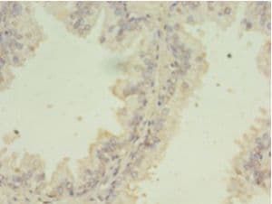 SNRPB2 Antibody (aa1-225)