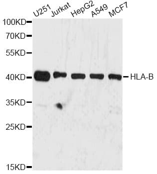 IHC-plus™ HLA-B Antibody