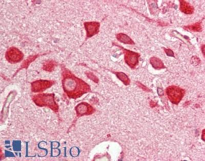 IHC-plus™ Polyclonal Rabbit anti-Human CAPRIN1 Antibody (aa450-500, IHC, WB)