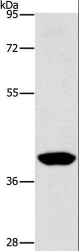 PHYKPL / AGXT2L2 Antibody
