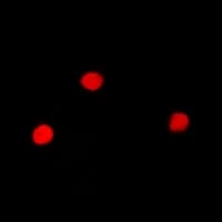 Polyclonal Rabbit anti-Human SNRPA / U1A Antibody (IHC, IF, WB)