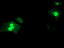 SDS Antibody (clone OTI2C11)