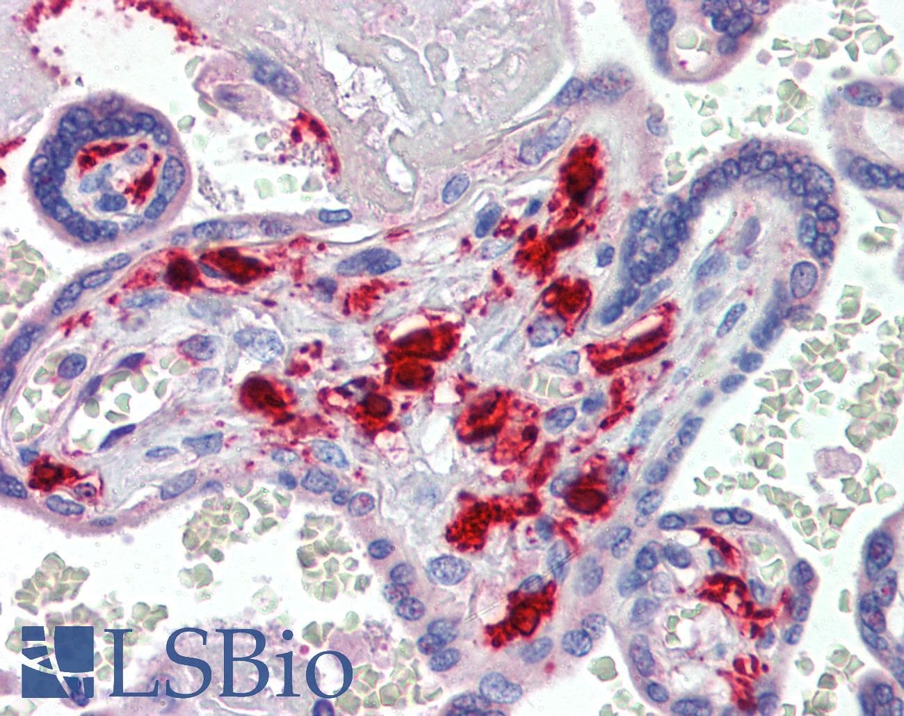 IHC-plus™ Polyclonal Goat anti-Human F13A1 / Factor XIIIa Antibody (IHC)