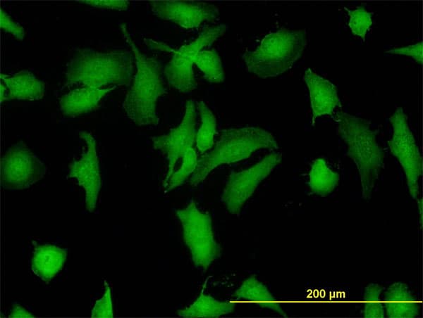 IHC-plus™ Monoclonal Mouse anti-Human STI1 / STIP1 Antibody (clone 1E3, IHC, IF, WB)