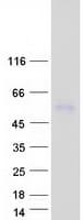 Human LRTM2 Protein (Recombinant Myc-DDK (Flag))