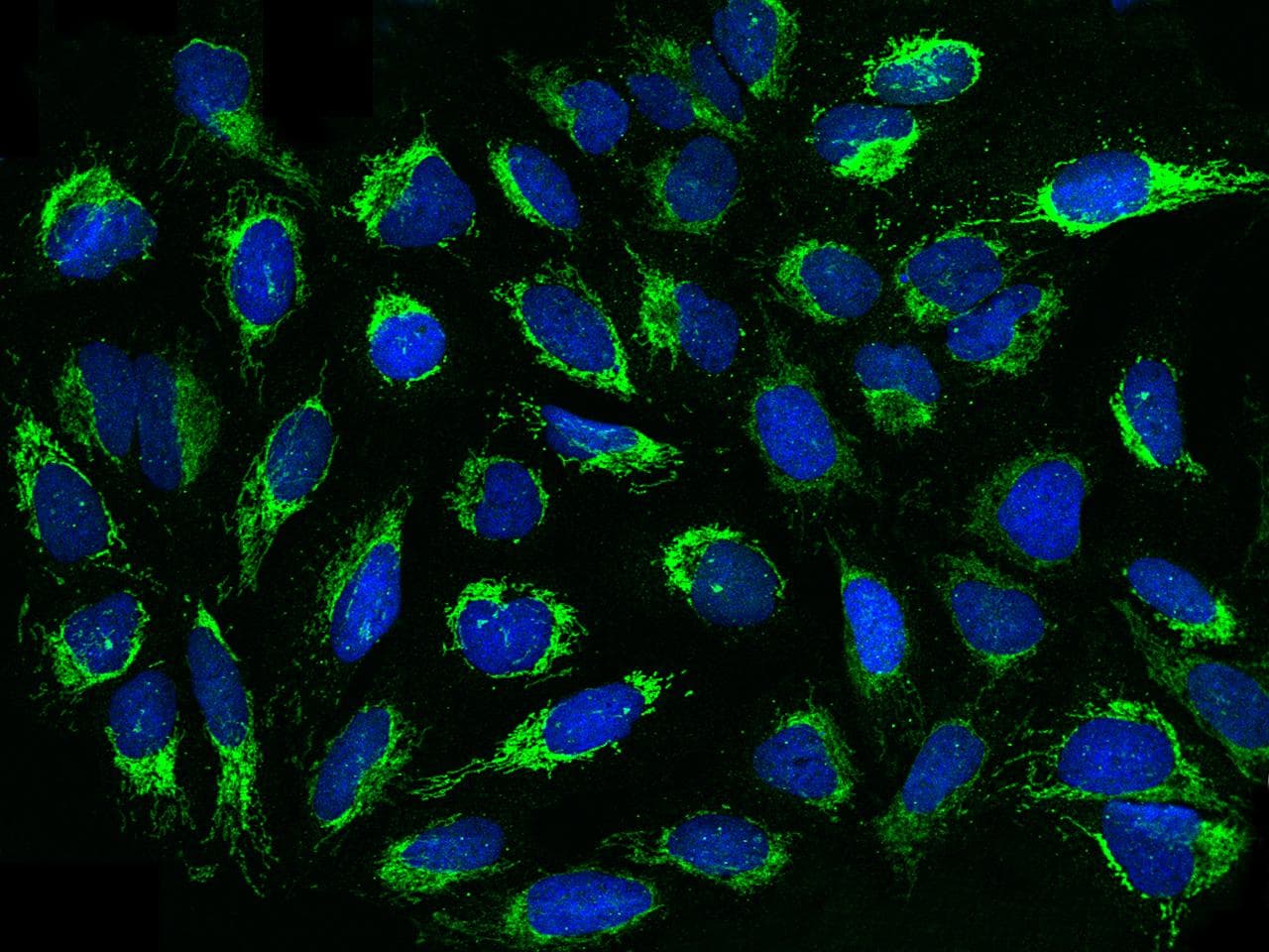RBKS / Ribokinase Antibody (Preservative Free)