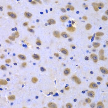 Polyclonal Rabbit anti-Human CIAO1 Antibody (IHC, WB)