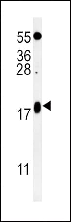 Polyclonal Rabbit anti-Human VAMP4 / VAMP-4 Antibody (aa16-45, IHC, WB)